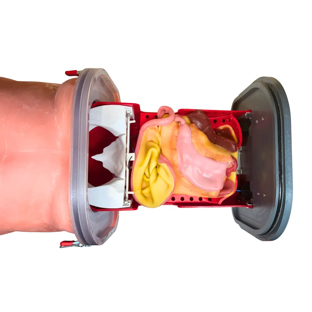 gastric-class-iv-2.webp