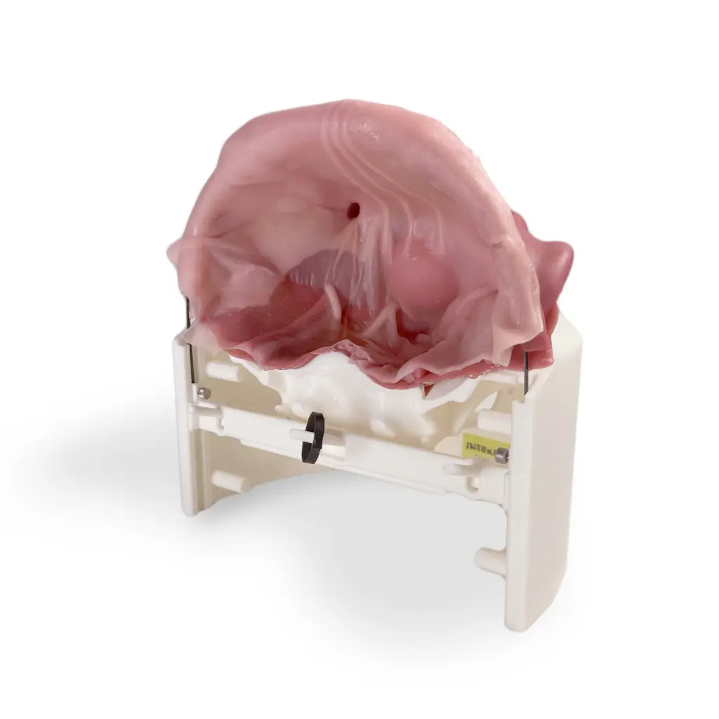 Inguinal34_April2025_3_a131ac61-5817-406b-9c6e-5ee2d9c3232d.webp