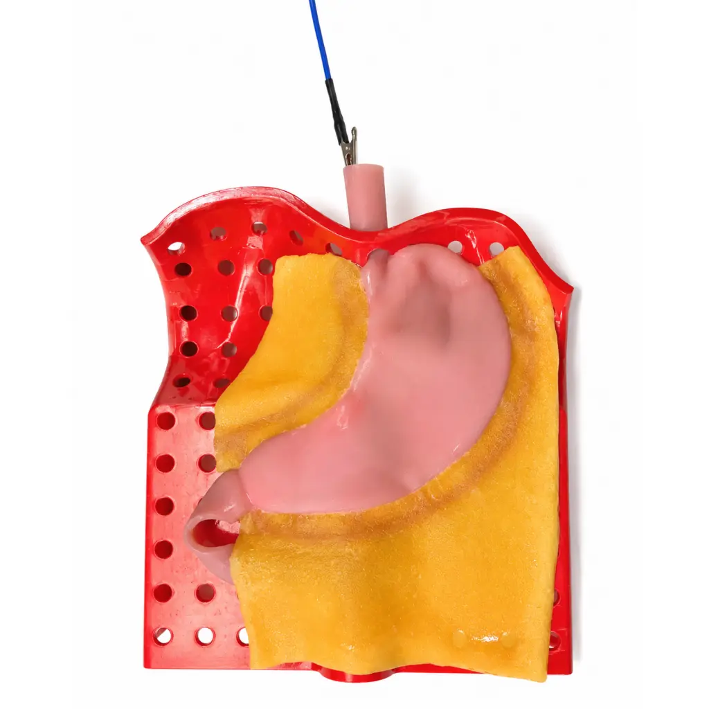 gastric-class-iii-2.webp