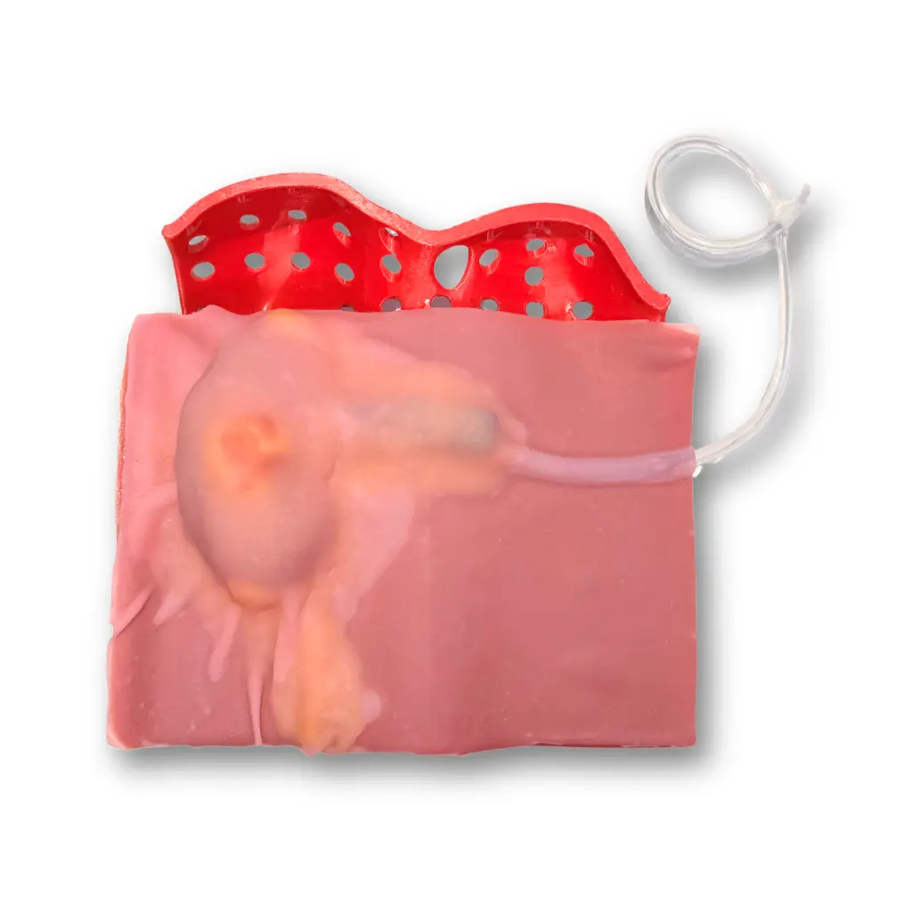 partial-nephrectomy-class-iv-3.webp