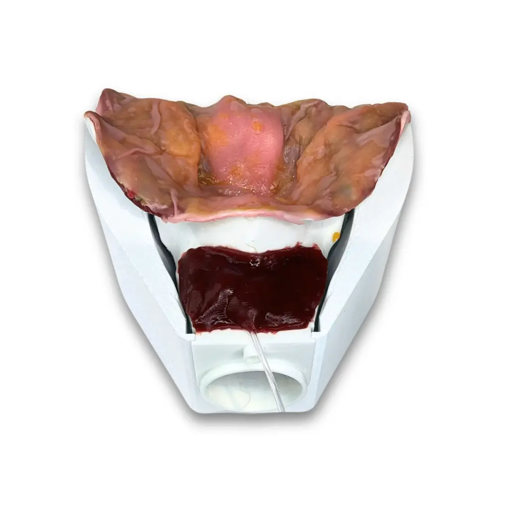 prostatectomy-class-v-2_12135fa1-4b26-4566-b985-c89de64a2510.webp
