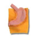 Gastric (Class III)