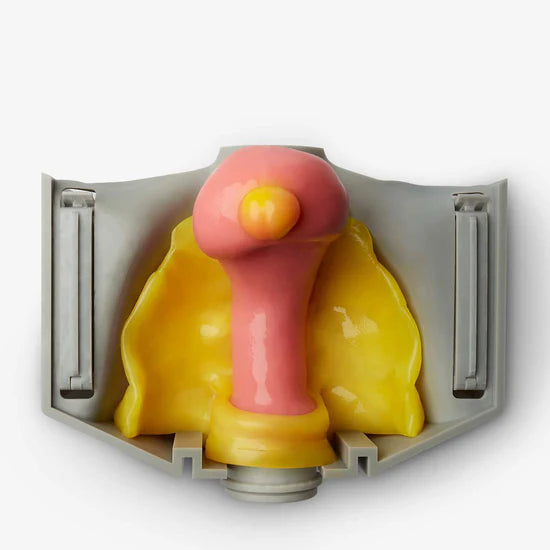 Myomectomy (Class II)