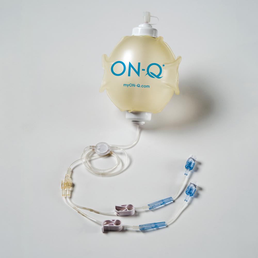 ON-Q Kit med pump (270 ml, 2 ml) & dubbla katetrar (12,5 cm)