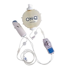 ON-Q-CB: Pumpar med variabelt flöde och/eller bolus