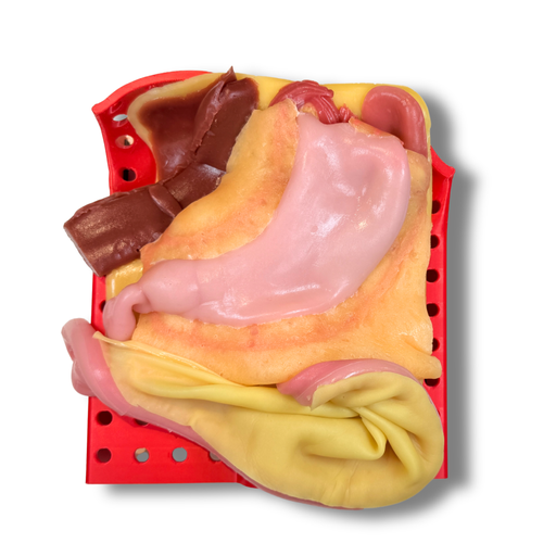 [GENGASIV] Gastric (Class IV)