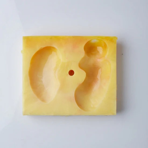 [UROPNBI] Partial Nephrectomy Fat Base (Class I)