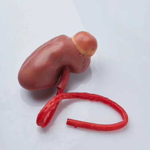 [UROPNPII] Partial Nephrectomy (Class II)